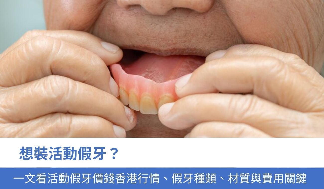 活動假牙價錢香港行情