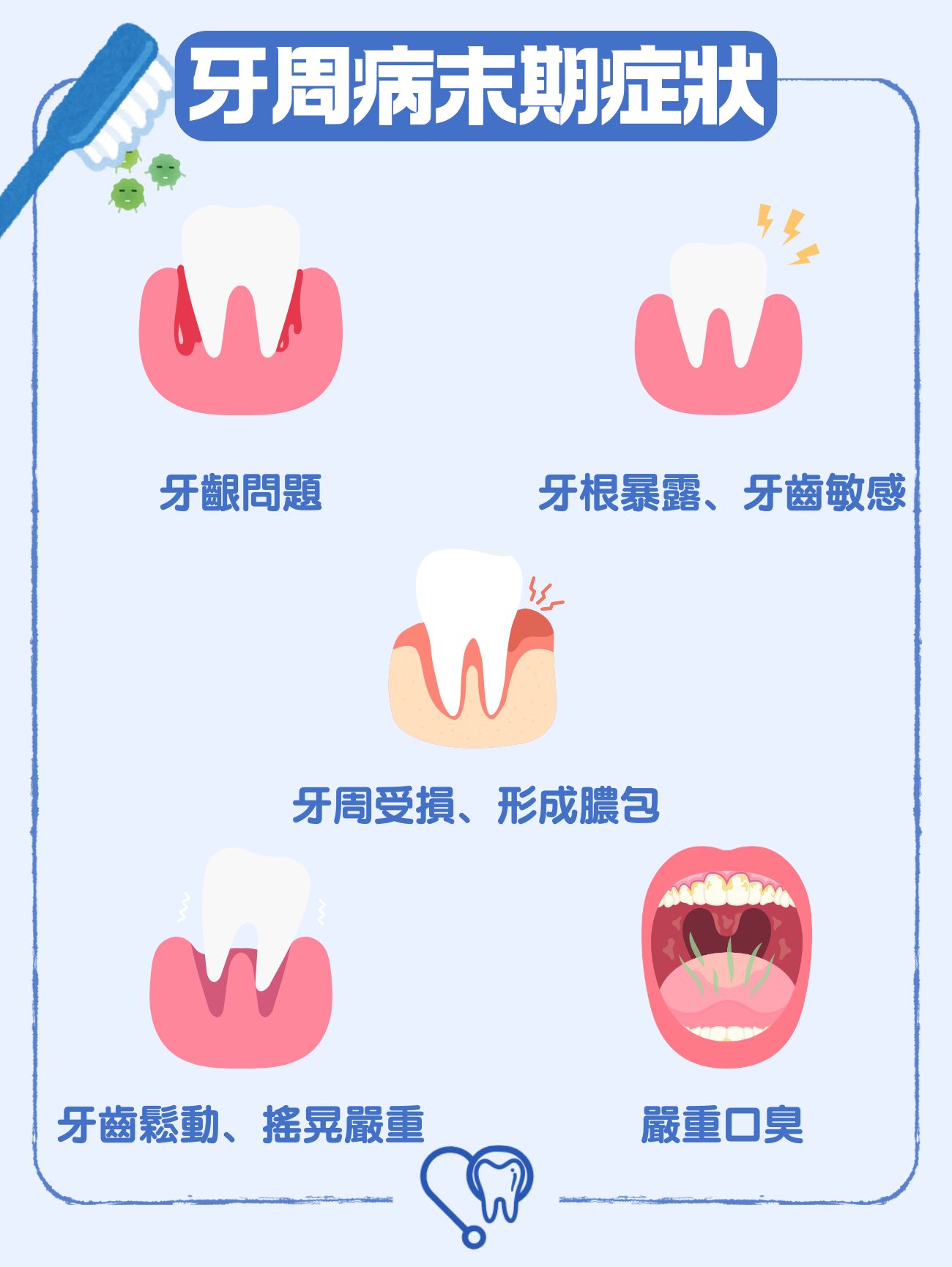 牙周病末期症狀