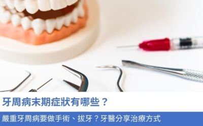 牙周病末期症狀有哪些？嚴重牙周病要做手術、拔牙？牙醫分享5大治療方式