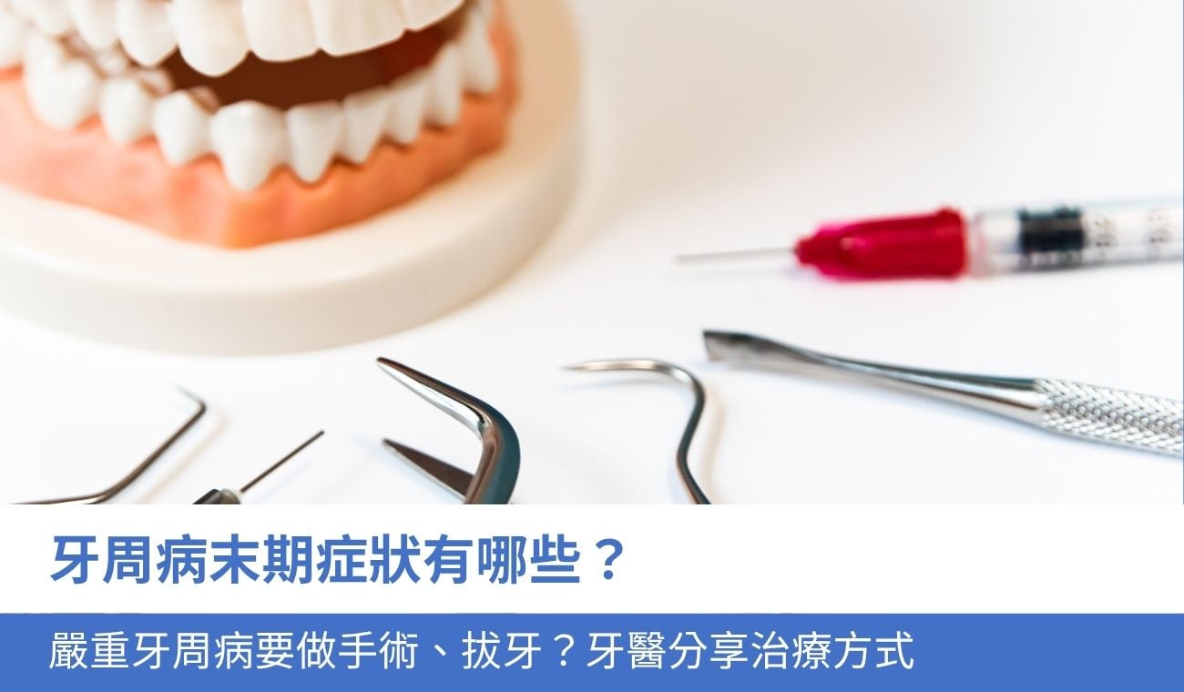 牙周病末期症狀有哪些？嚴重牙周病要手術嗎？牙醫話你知5大治療方式