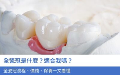 牙科知識庫 7 全瓷冠是什麼?適合我嗎?全瓷冠5大流程、價錢、保養一文看懂