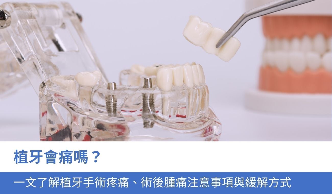 are-dental-implants-painful