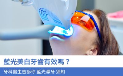 牙科知識庫 8 藍光美白牙齒有效嗎?牙科醫生告訴你4大 藍光漂牙 須知