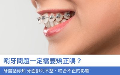 牙科知識庫 2 哨牙問題一定需要矯正嗎?牙醫話你知 牙齒排列不整、咬合不正的3大影響