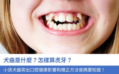 犬齒是什麼？怎樣算虎牙？小孩牙齒突出的4大口腔健康影響爸媽要知道！