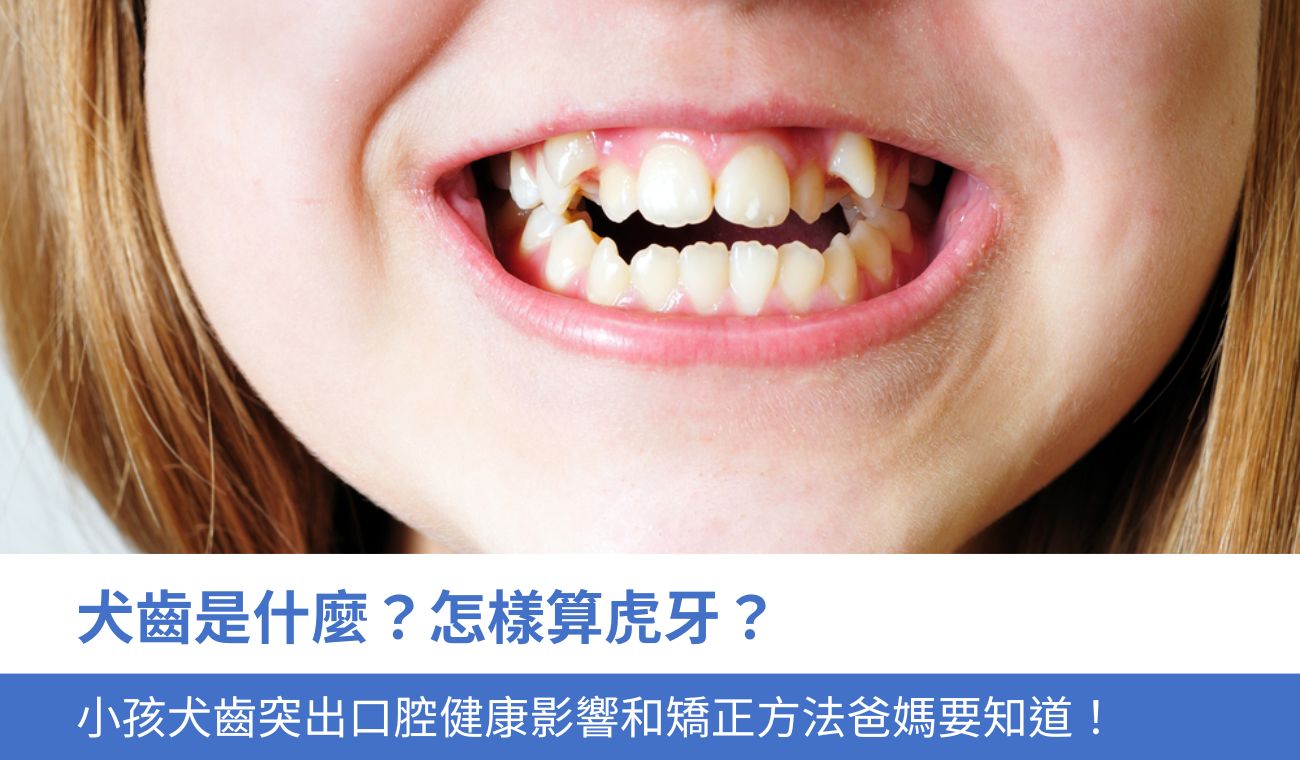 犬齒是什麼?