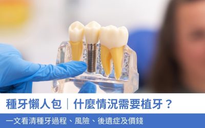 【種牙全面睇】什麼情況要植牙？一文看清手術過程、風險、後遺症及價錢