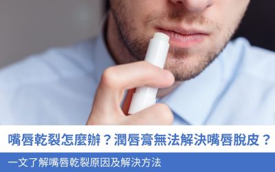 嘴唇乾裂怎麼辦？潤唇膏無法解決嘴唇脫皮？一文了解5大嘴唇乾裂原因及解決方法