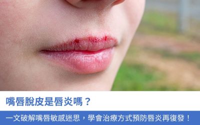 嘴唇脫皮是唇炎嗎？一文破解嘴唇敏感迷思，學會4大治療方式預防唇炎再復發！