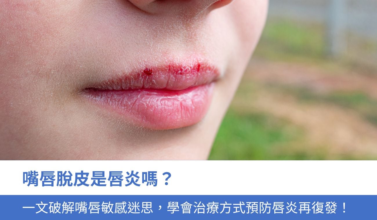 嘴唇脫皮是唇炎嗎？