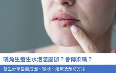 嘴角生瘡生水泡怎麼辦？會傳染嗎？醫生分享4大唇瘡成因、徵狀、治療及預防方法