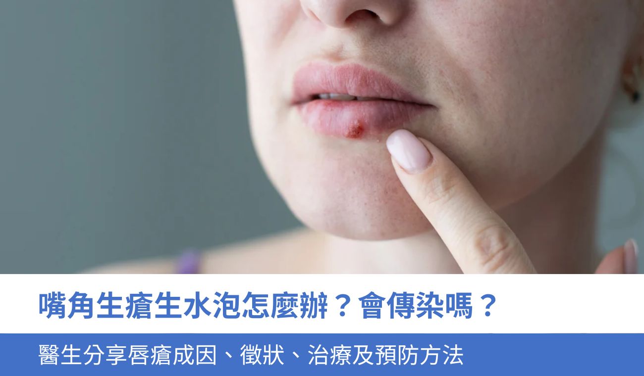 嘴角生唇瘡怎麼辦？