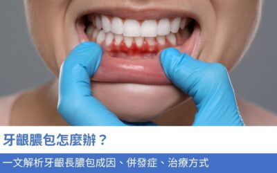 牙科知識庫 2 牙齦膿包怎麼辦?一文解析4大 牙齦長膿包成因、併發症、治療方式,幫你預防 細菌感染