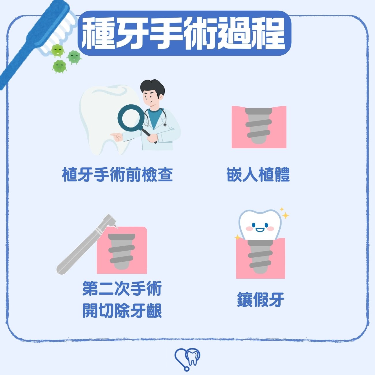 種牙手術過程