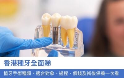 牙科知識庫 10 香港種牙全面睇:3大植牙手術種類、適合對象、過程、價錢及術後保養一次看
