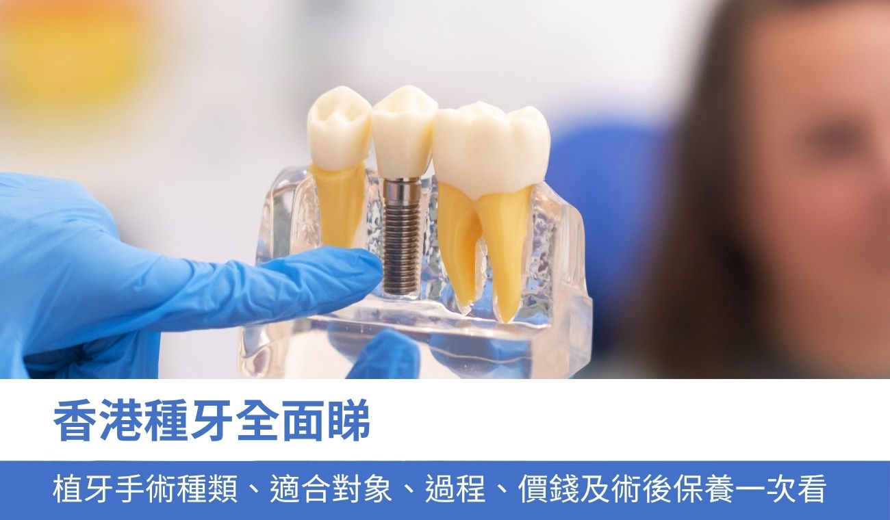dental-implant-surgery 種牙全面睇:3大植牙手術種類、適合對象、過程及價錢一次看