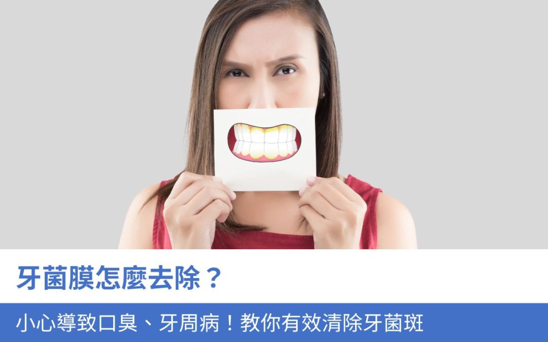 牙菌膜怎麼去除？小心導致口臭、牙周病！3招教你有效清除牙菌斑