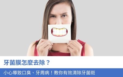 牙菌膜怎麼去除？小心導致口臭、牙周病！3招教你有效清除牙菌斑
