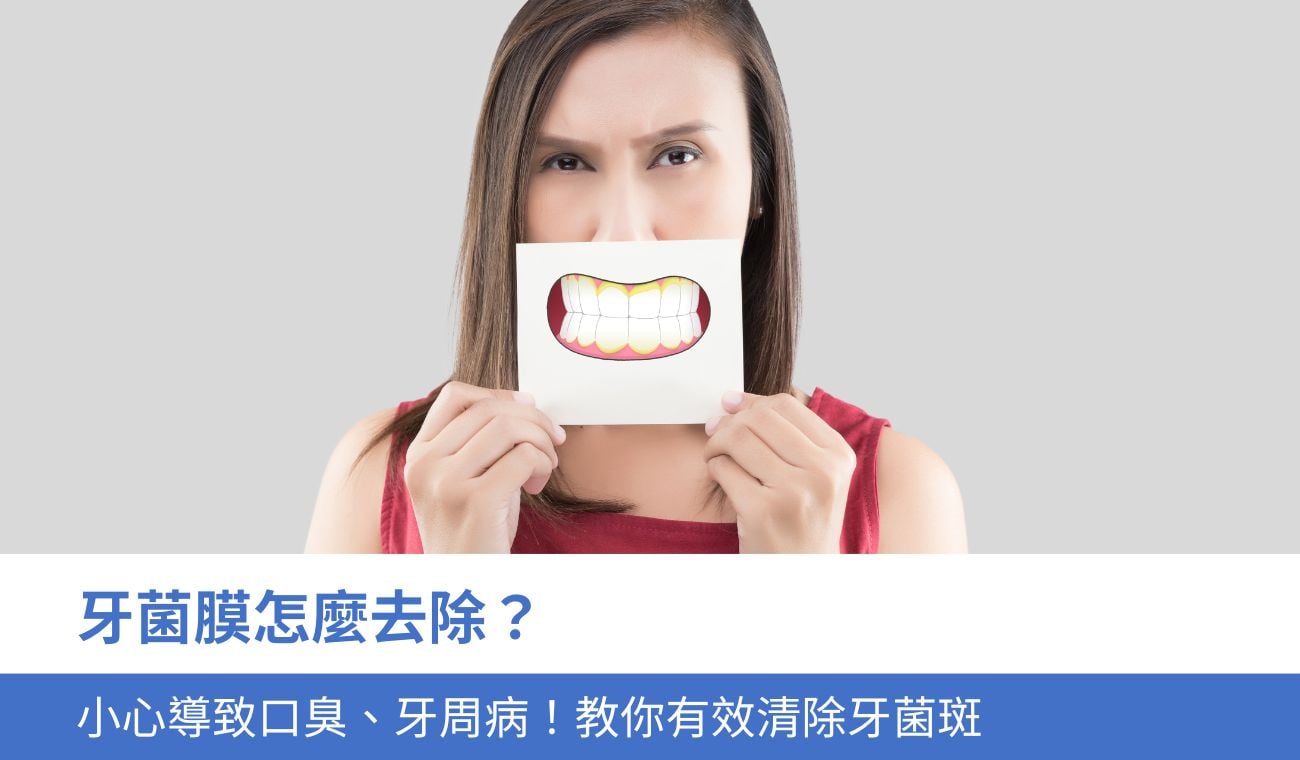 牙菌膜怎麼去除？