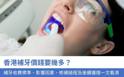 2025 香港補牙價錢要幾多？ 補牙收費標準、影響因素、修補過程及後續護理一文看清