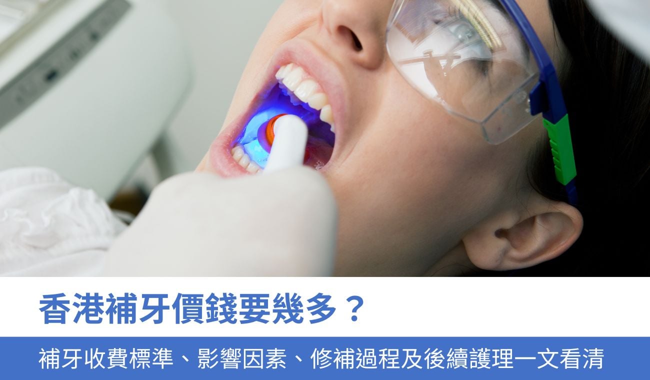 香港補牙價錢