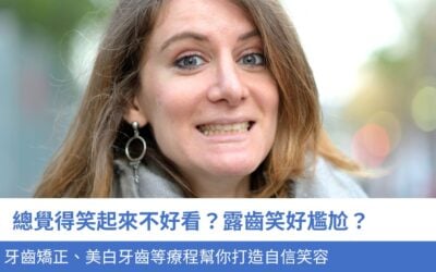總覺得笑起來不好看？露齒笑好尷尬？牙齒矯正、美白牙齒等4種療程幫你打造自信笑容