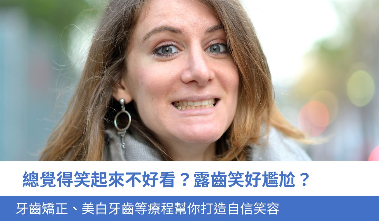 覺得笑起來不好看？露齒笑好尷尬？牙齒矯正、美白等4種療程幫你打造自信笑容