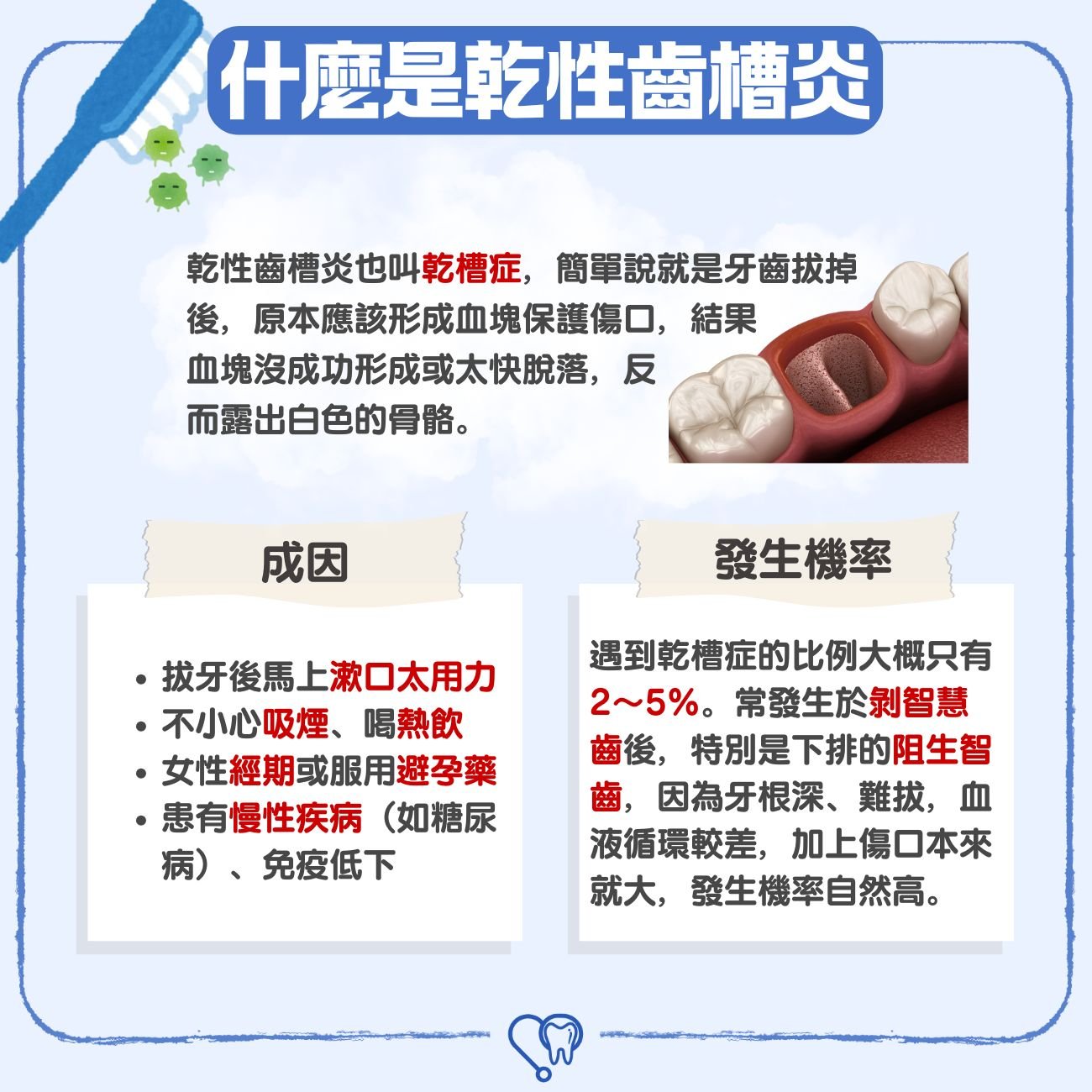 什麼是乾性齒槽炎（乾槽症）？