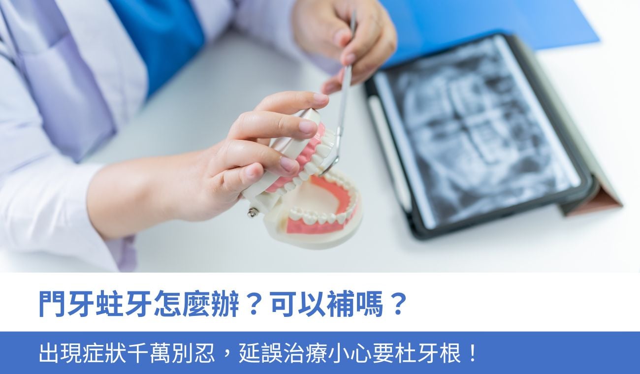 門牙蛀牙怎麼辦？
