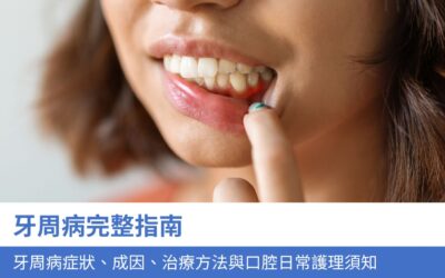 牙科知識庫 13 牙周病完整指南:牙周病症狀、成因、治療方法與口腔日常護理須知