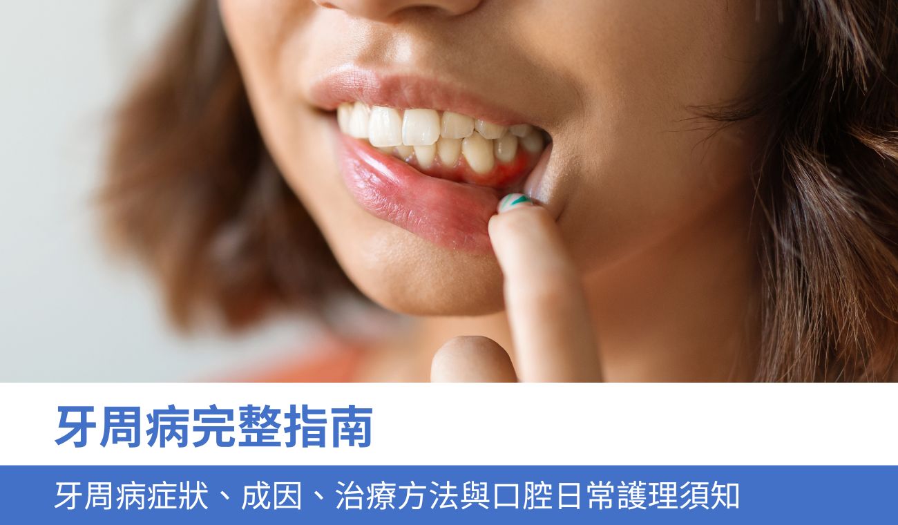 牙周病完整指南:5大牙周病原因、症狀、治療方法與日常口腔護理須知