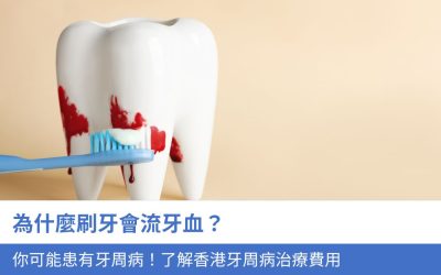 為什麼刷牙會流牙血？你可能患有牙周病！3分鐘了解香港牙周病治療費用