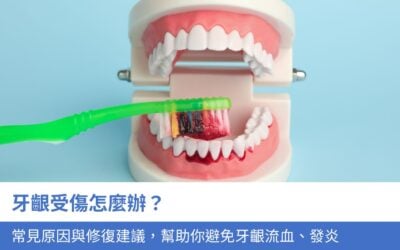 牙齦受傷怎麼辦？7個常見原因與修復建議，幫助你避免牙齦流血、發炎