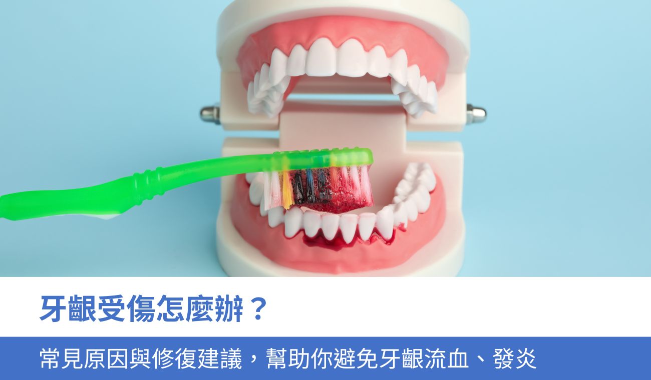 牙齦受傷怎麼辦？7個常見原因與修復建議，幫助你避免牙齦流血、發炎