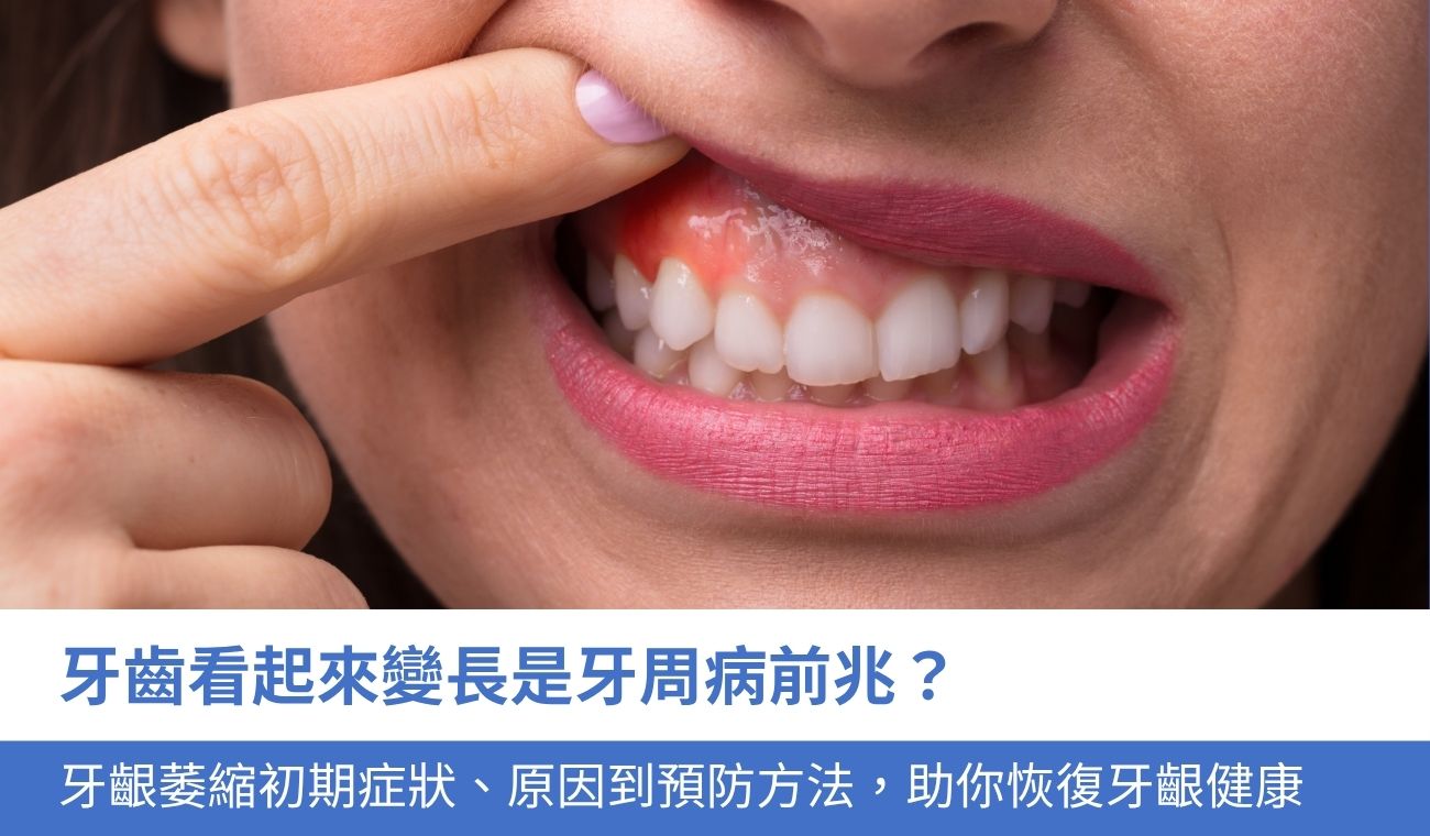 gum-recession-early-signs 牙齦萎縮初期是牙周病前兆嗎?5大症狀、原因到預防方法,恢復牙齦健康