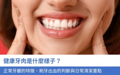 健康牙肉是什麼樣子?正常牙齦的 4 個特徵、刷牙出血的判斷與日常清潔重點