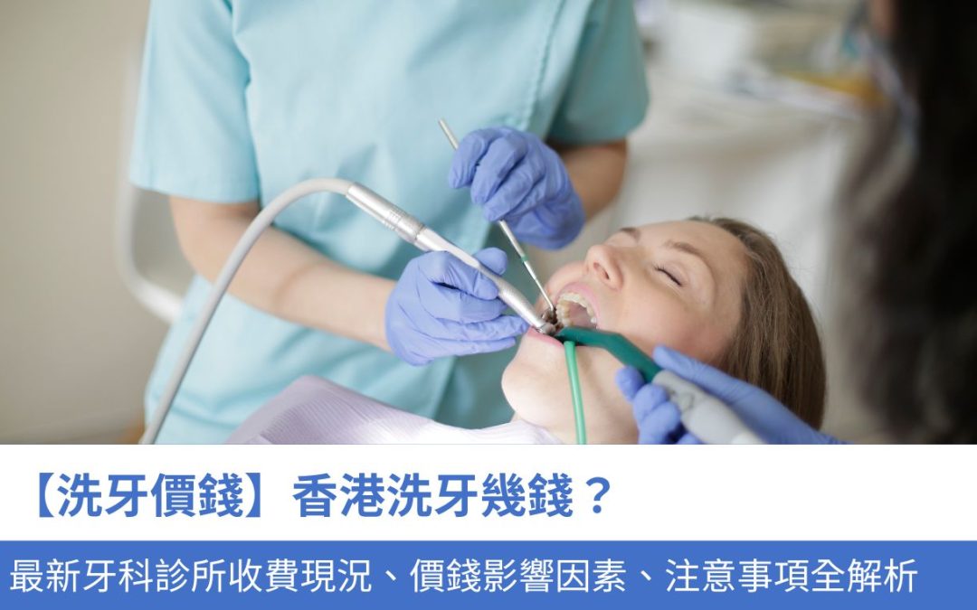 【洗牙價錢】香港洗牙幾錢？最新牙科診所收費現況、價錢影響因素、注意事項全解析