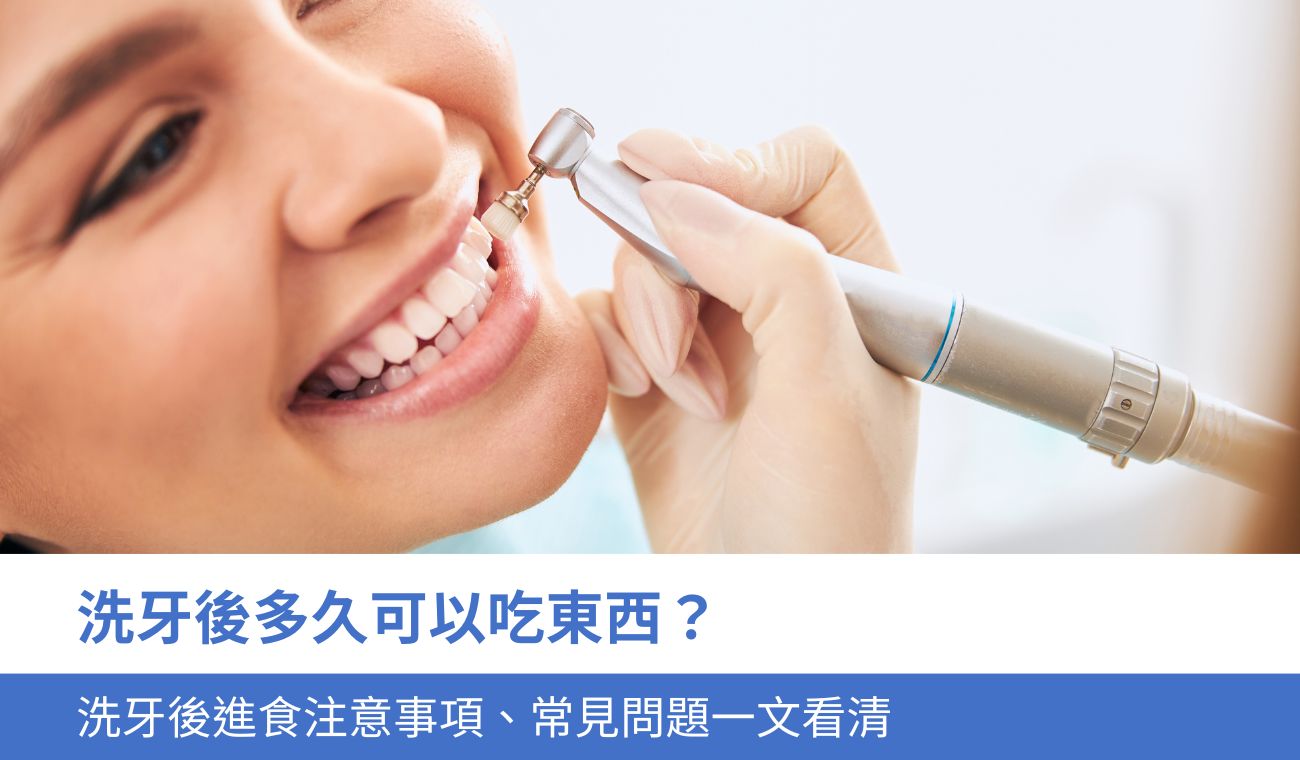 洗牙後多久可以吃東西？