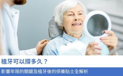 植牙可以撐多久？影響年限的 5 大關鍵及植牙後的保養貼士全解析
