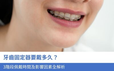 牙科知識庫 4 牙齒固定器要戴多久?3階段佩戴時間及影響因素全解析