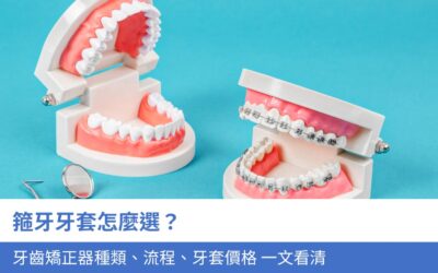 牙齒矯正(箍牙) 11 箍牙 牙套 怎麼選?4大 牙齒 矯正器種類、流程、牙套價格 一文看清