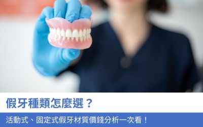 牙科知識庫 4 假牙種類:活動式與固定式怎麼選?假牙材質價錢分析一次看!