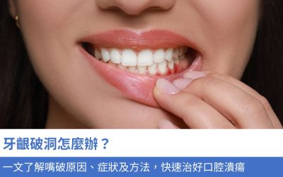 牙齦破洞怎麼辦？一文了解5大嘴破原因、症狀及方法，快速治好口腔潰瘍