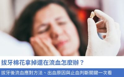 拔牙棉花拿掉還在流血怎麼辦？3大拔牙後流血應對方法、出血原因與止血判斷關鍵一次看