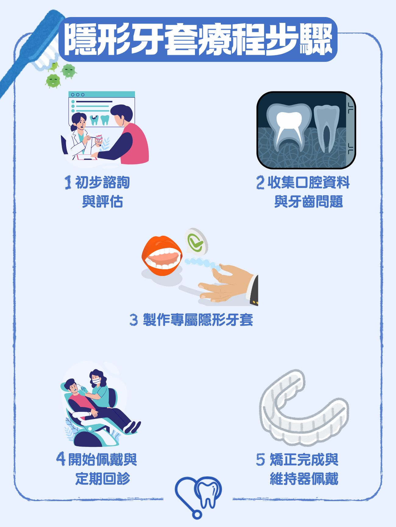隱形牙套療程5步驟