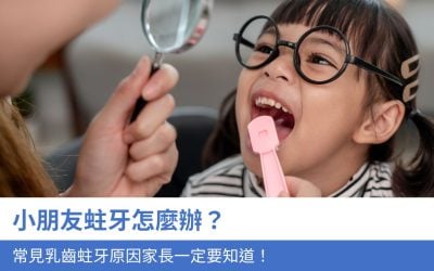 小朋友蛀牙怎麼辦？3大常見乳齒蛀牙原因家長一定要知道！