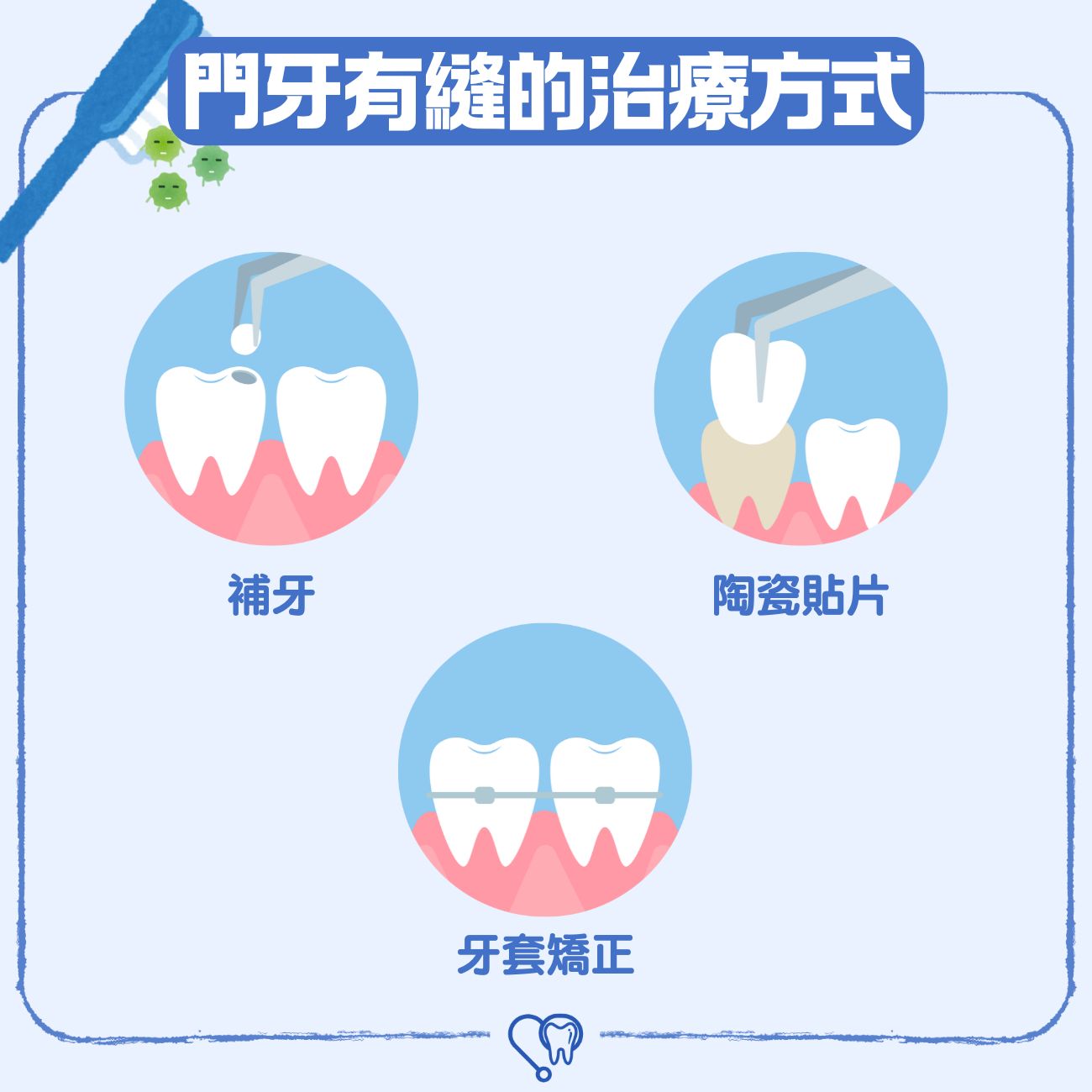 小朋友門牙有縫怎麼辦?要矯正嗎?3種治療方式恢復牙齒整齊,不再牙縫變大 4 門牙有縫的治療方式