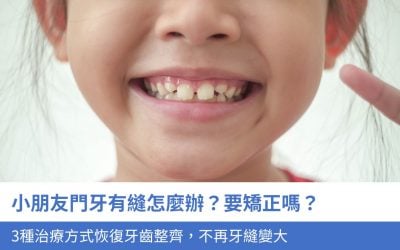 小朋友門牙有縫怎麼辦？要矯正嗎？3種治療方式恢復牙齒整齊，不再牙縫變大