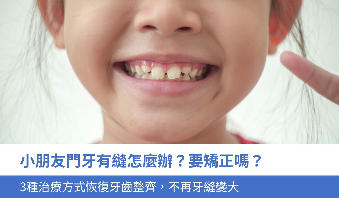 小朋友門牙有縫怎麼辦?
