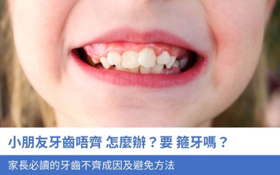 小朋友牙齒唔齊怎麼辦？要 箍牙嗎？家長必讀的4大牙齒不齊成因及避免方法